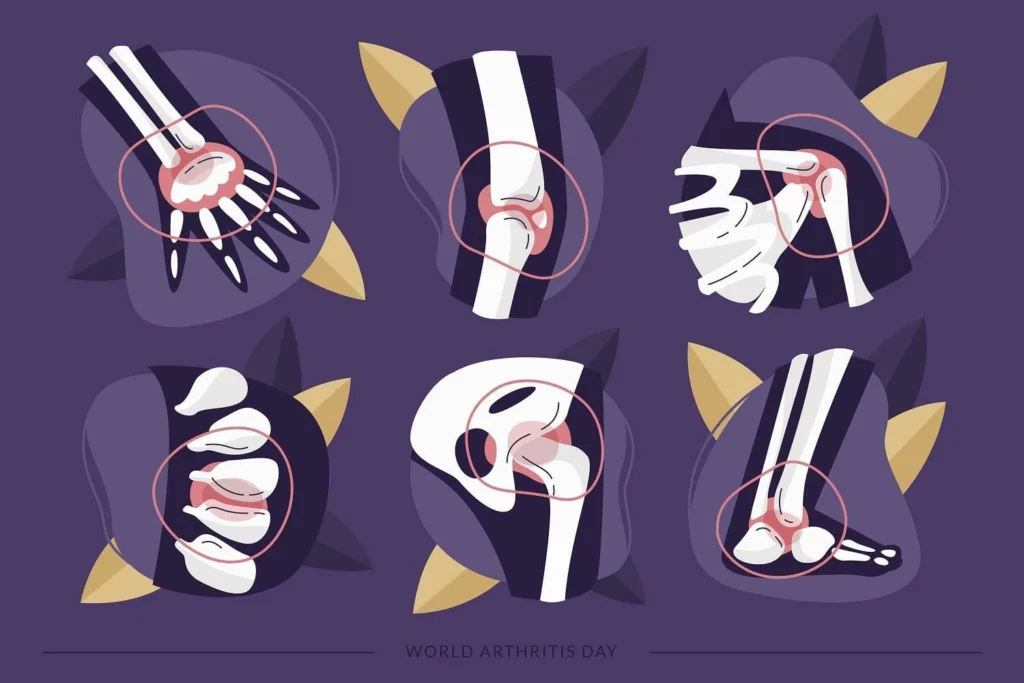 arthoroscopy surgery